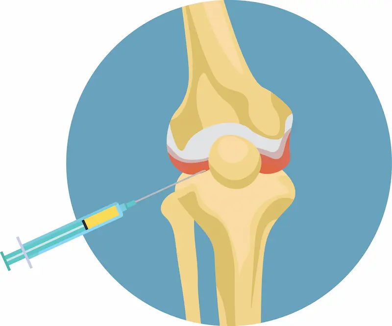 PRP Injections for Joint Pain; A Comprehensive Guide